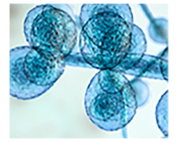 BioGX Candida Auris PCR Assay Global Adoption Accelerates
